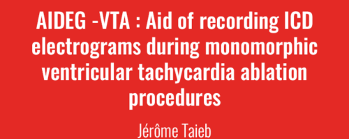 Newsletter Mai 2023 - AIDEG -VTA : Aid of recording ICD electrograms during monomorphic ventricular tachycardia ablation procedures